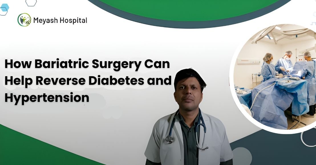 How Bariatric Surgery Can Help Reverse Diabetes and Hypertension