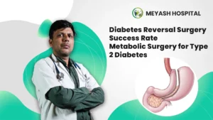 Diabetes Reversal Surgery Success Rate – Metabolic Surgery for Type 2 Diabetes
