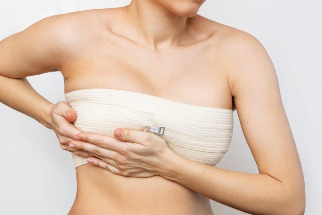 Scars of breast uplift