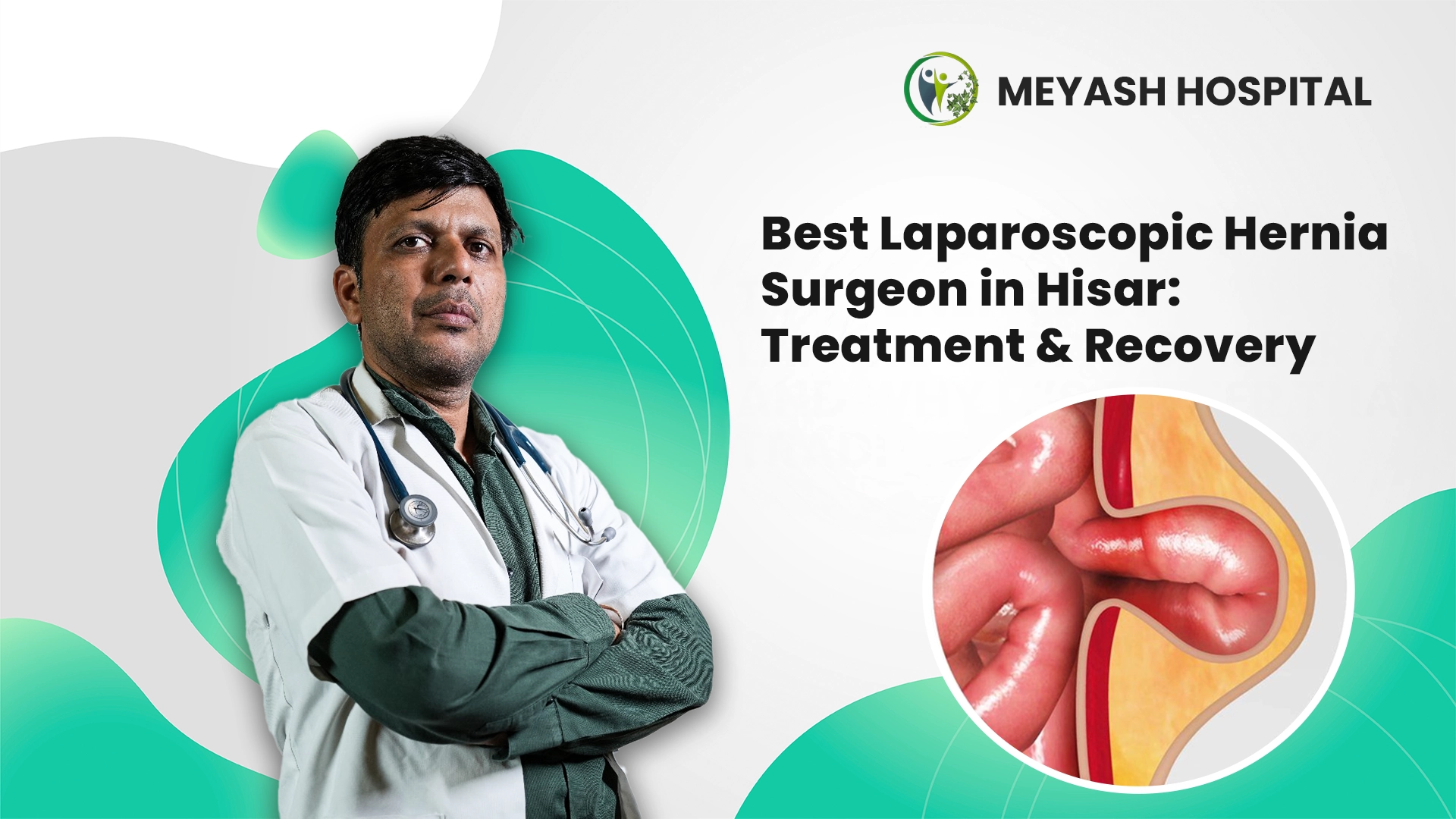 Best Laparoscopic Hernia Surgeon in Hisar