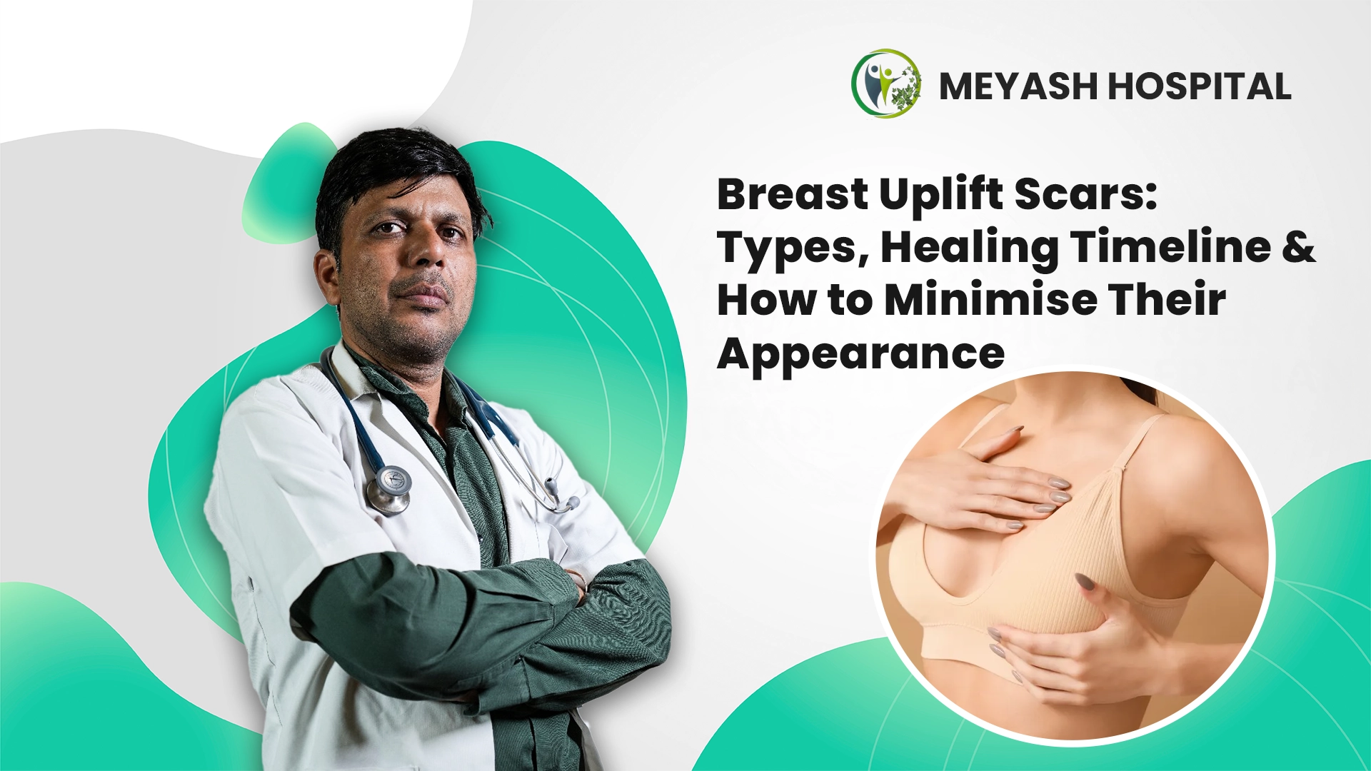 Breast Uplift Scars