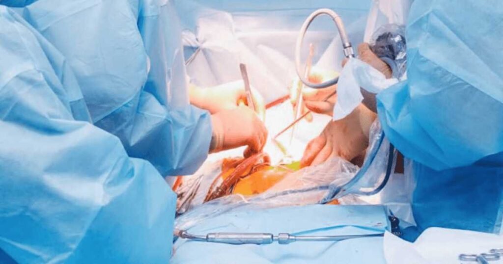 Factors That Affect Laparoscopic Hernia Surgery Time