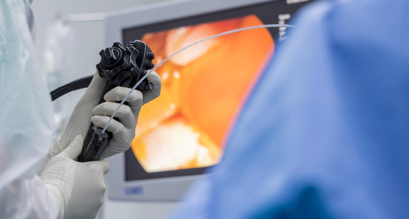Key Advantages of Laparoscopic Surgery