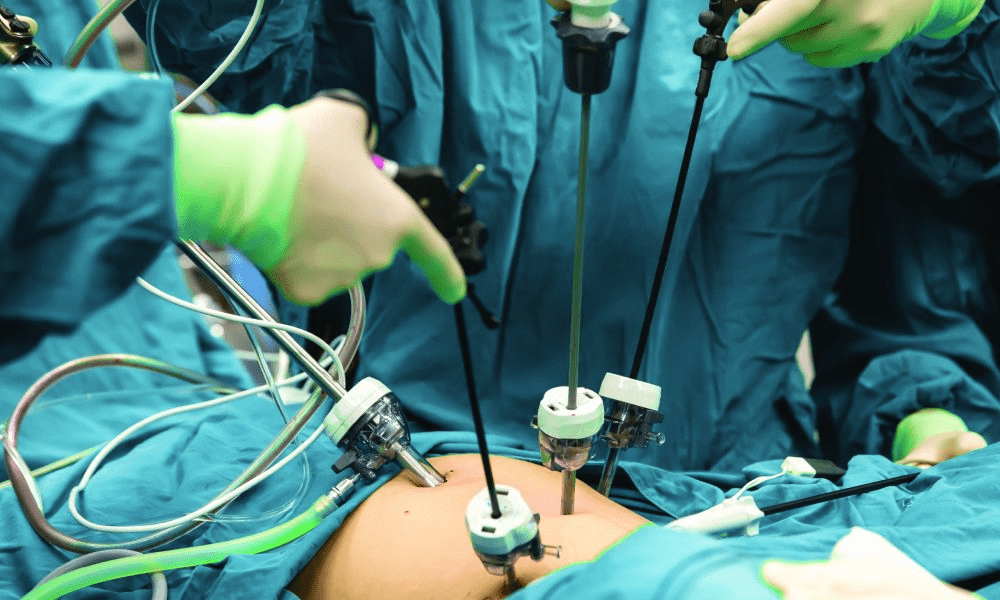 laparoscopic surgery pros and cons