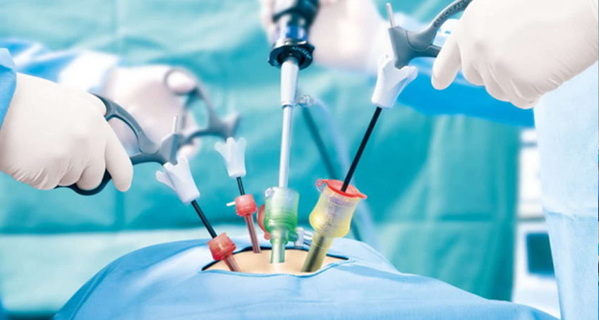 Top Surgery Hospitals in Haryana: What to Look For