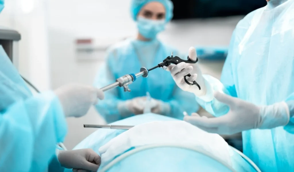 Recovery Time in Laparoscopic Surgery Pros and Cons