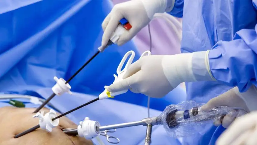 What is Laparoscopic Surgery and Why the Advantages of Laparoscopic Surgery Matter