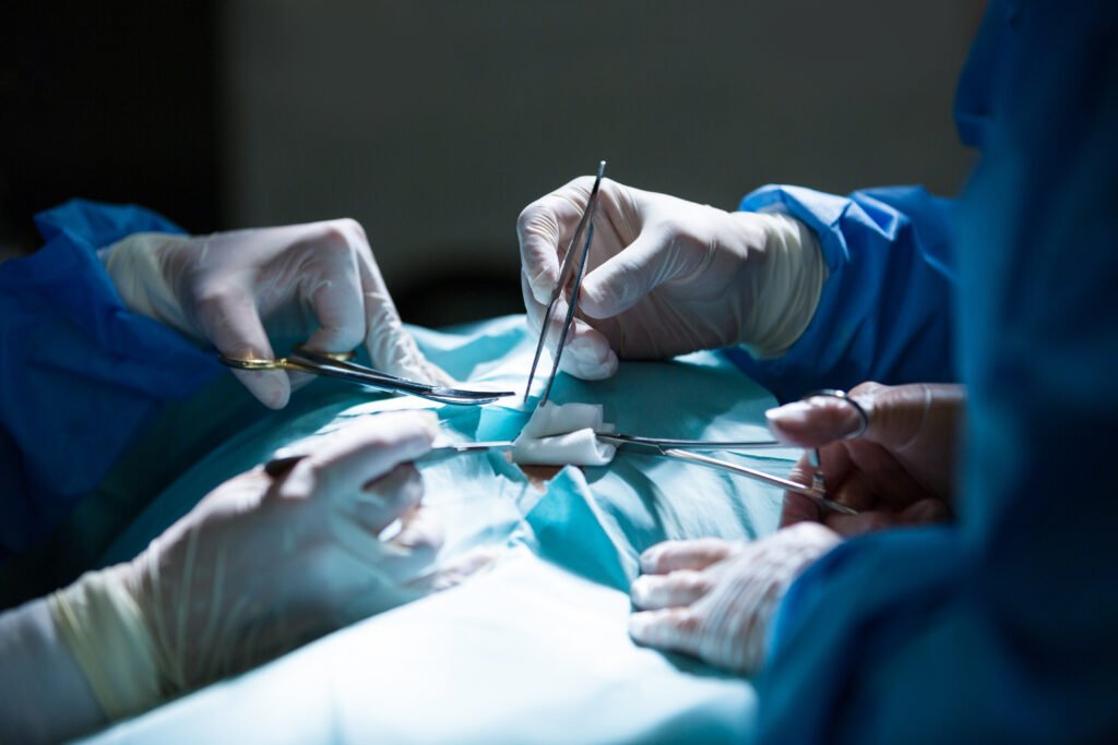 Role of Mesh in Hernia Surgery