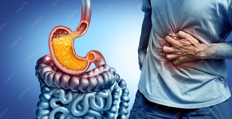 Treatment Differences