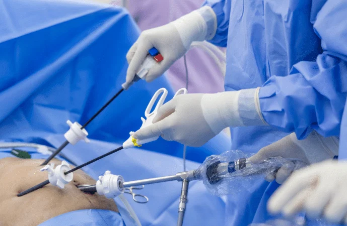  Laparoscopic Surgery Is Too Risky