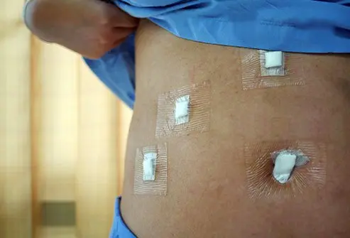 The Gas Used in Laparoscopy Is Dangerous