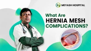 What Are Hernia Mesh Complications? Doctor with hernia mesh implant illustration in Meyash Hospital featured image.