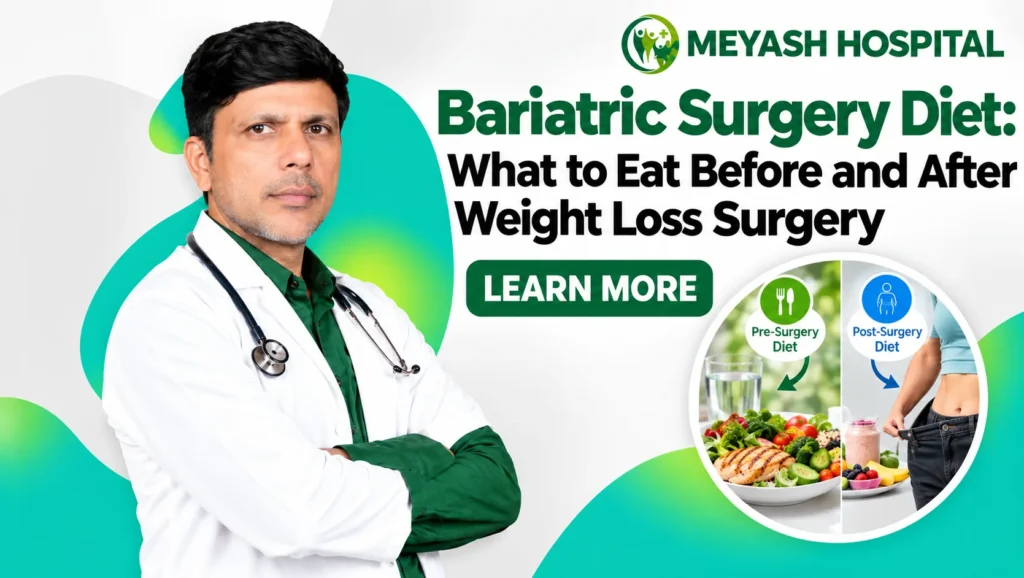 Bariatric Surgery Diet