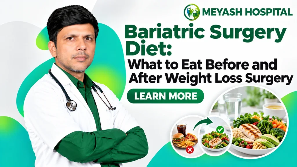 Bariatric Surgery Diet