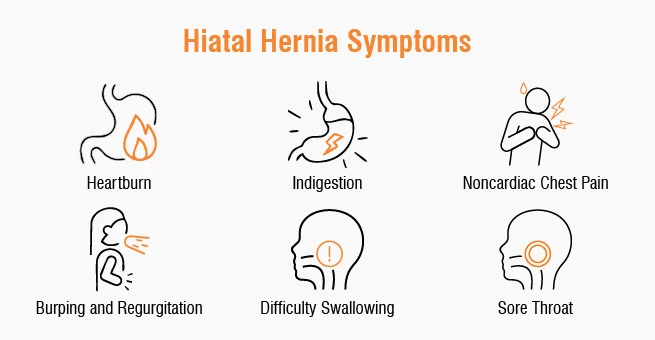 Hiatus Hernia Surgery Required